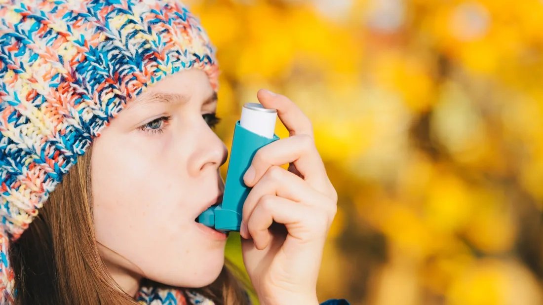 Allergic Asthma