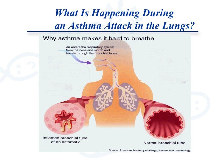 Asthma 101â?