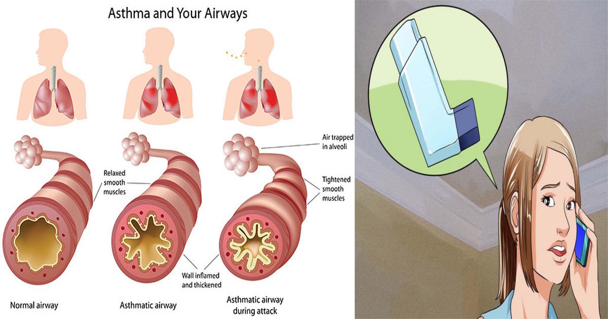 Asthma Attack Help No Inhaler