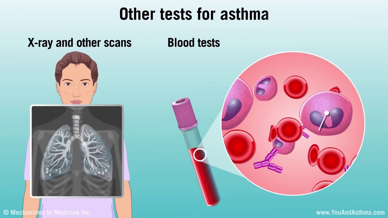 Asthma Diagnostic Testing