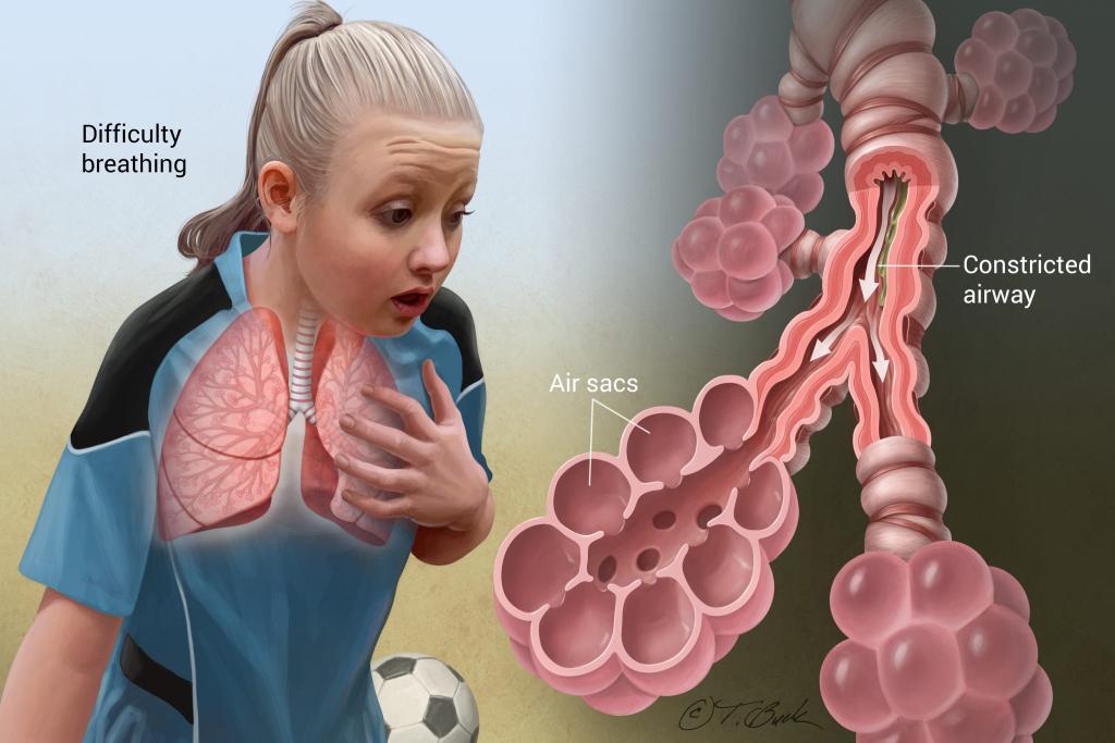 Asthma und Allergie