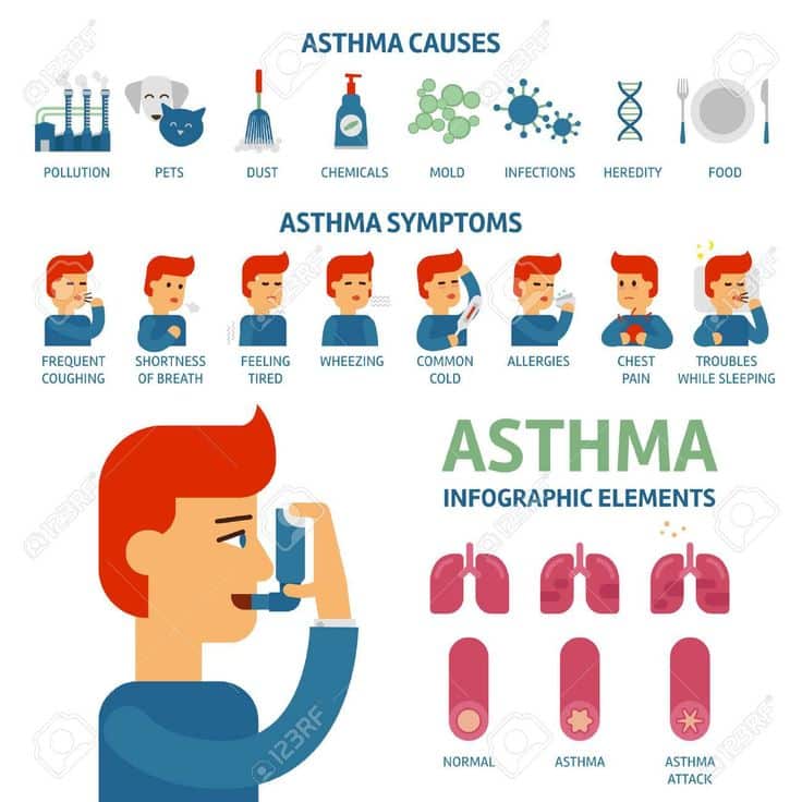 Causas y síntomas del asma. #asthma #symptoms #allergy