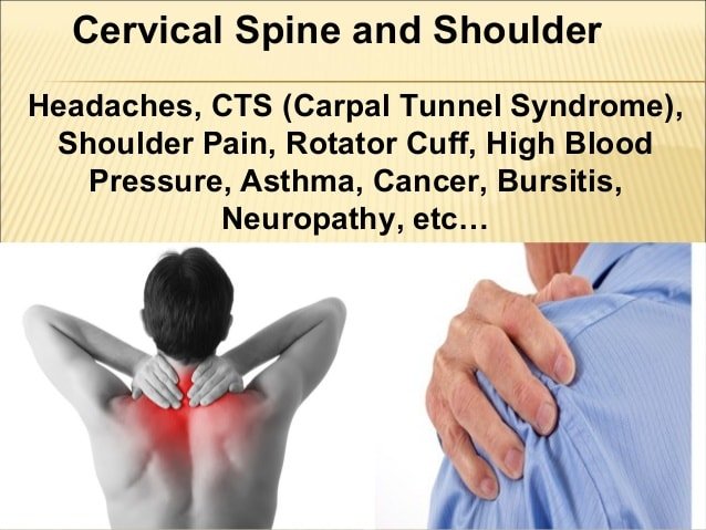 Cervical spine and shoulder problems