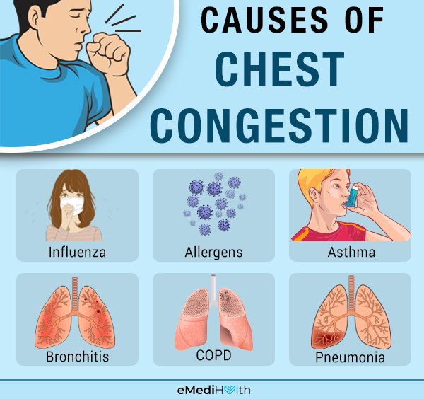 Chest Congestion: Causes, Symptoms, and Treatments