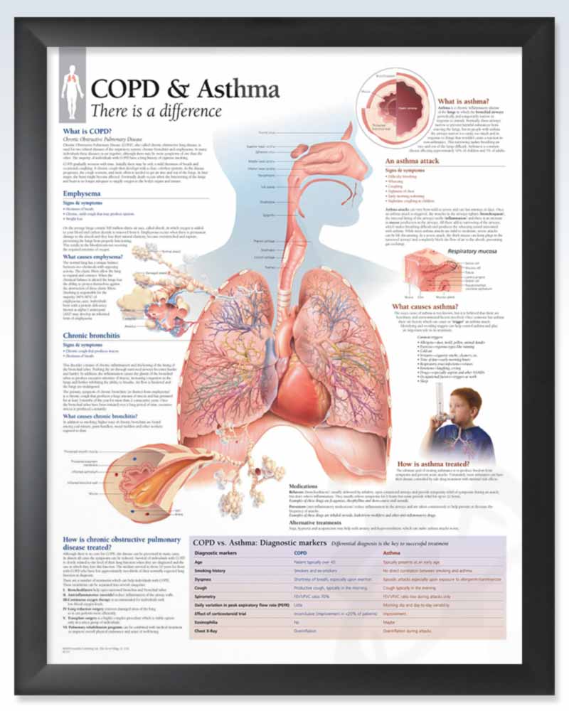 COPD &  Asthma Exam