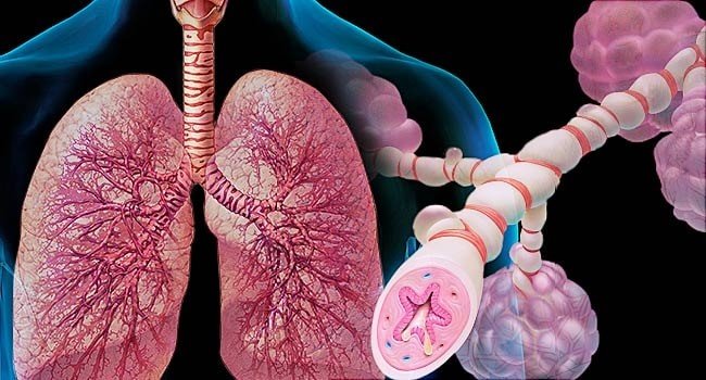 Everything You Need to Know About Asthma