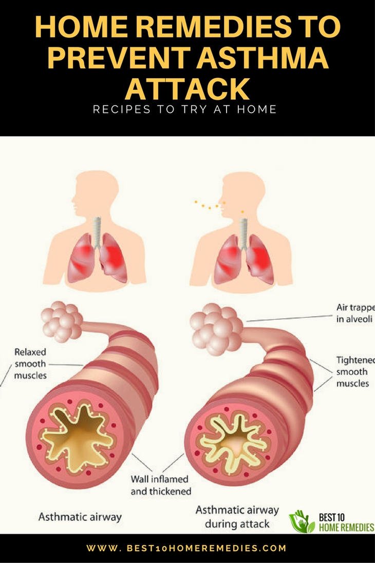 Home Remedies To Prevent Asthma Attack by willthomos on ...