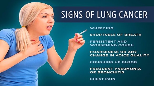 How Do You Know If You Have Lung Cancer From Smoking ...