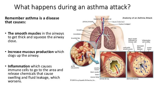 Lets talk about ASTHMA by Haley Taylor Schlitz