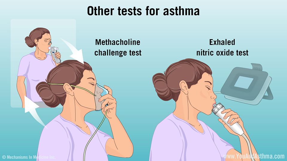 Other tests for asthma You might also have breathing tests ...
