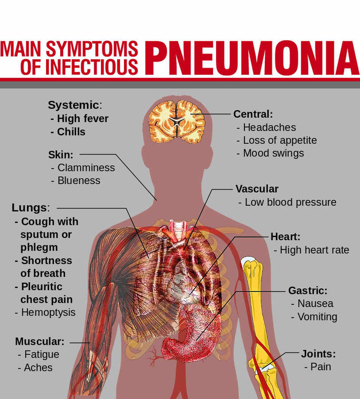 Pneumonia: The disease that kills 80 every day