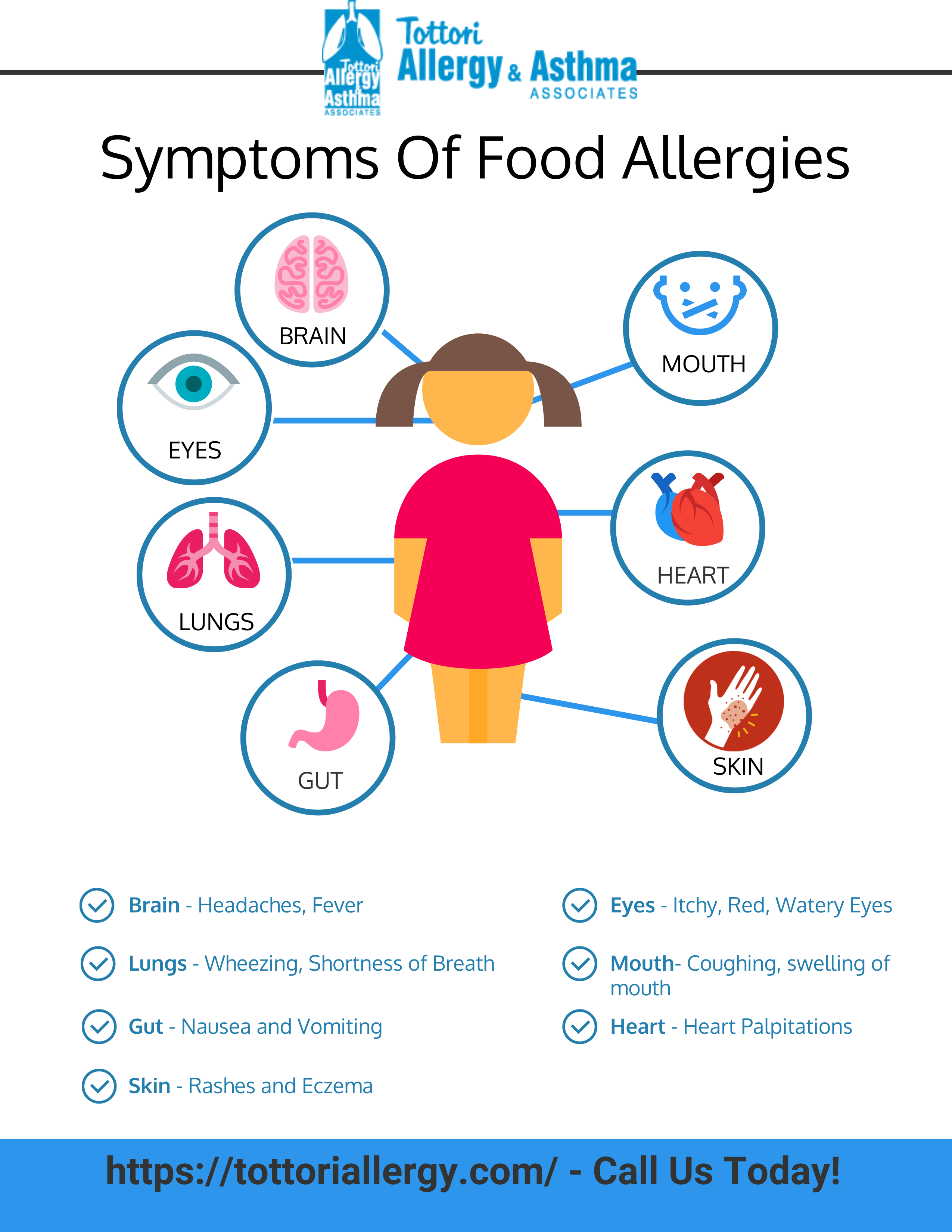 Symptoms of Food Allergies