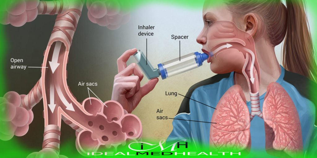 The cause of asthma with drugs for treatment