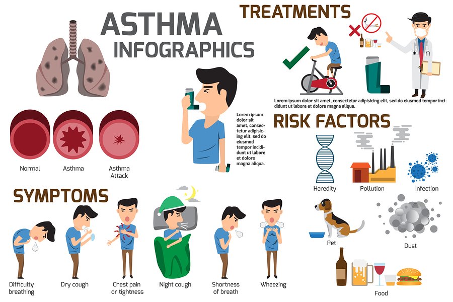 Treating Acute Asthma Attacks