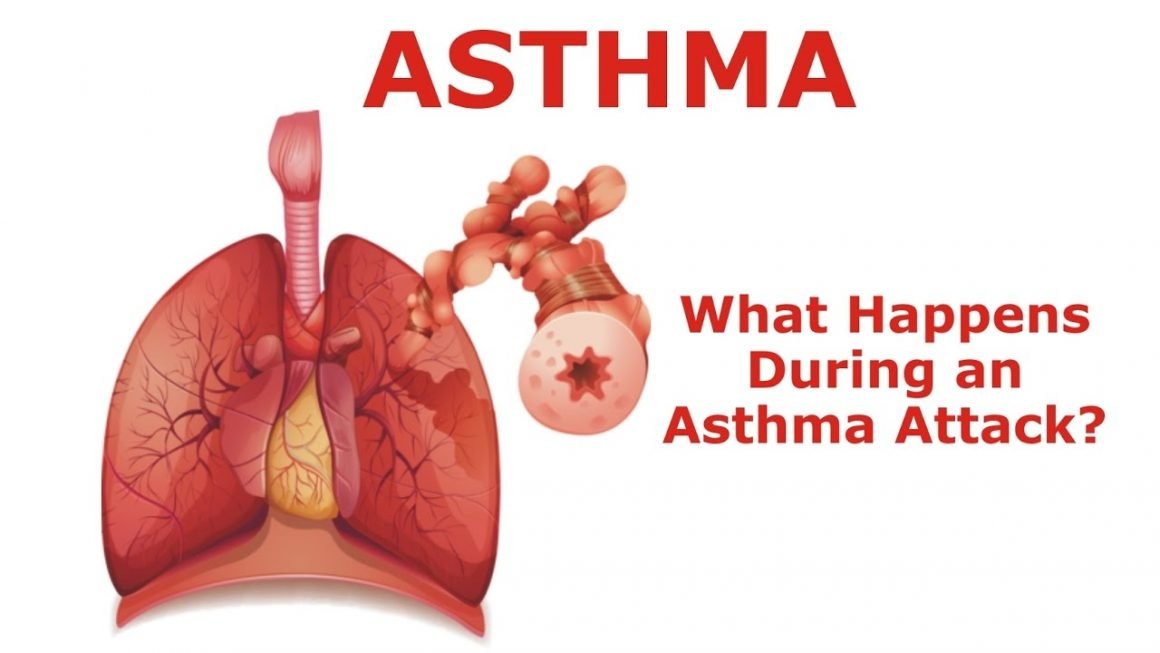What happens During Asthma Attack & What Causes It?